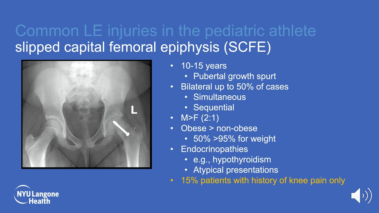 Lower Extremity Injuries in the Pediatric Athlete ABOS Orthopedic