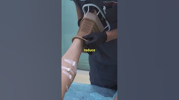 Do Compression Pants Help Recovery? Here