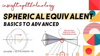 SPHERICAL EQUIVALENT Of EYE ||OPTOMETRY