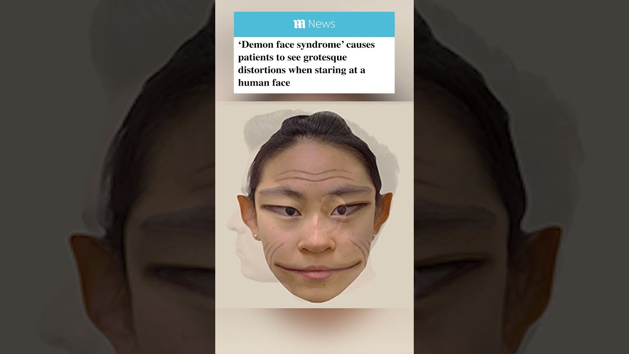 Here S What Human Faces Look Like To People With Prosopometamorphopsia AKA Demon Face Syndrome 