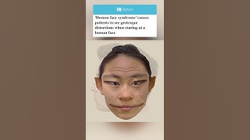 Here’s what human faces look like to people with prosopometamorphopsia AKA ‘demon face syndrome’ 😳