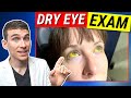 The Most Thorough Dry Eye Examination - Dry Eyes Testing Explained