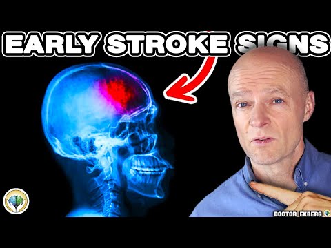 Video: 3 sätt att gå efter en stroke