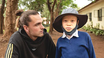 ¿Por qué se caza a los albinos en África?