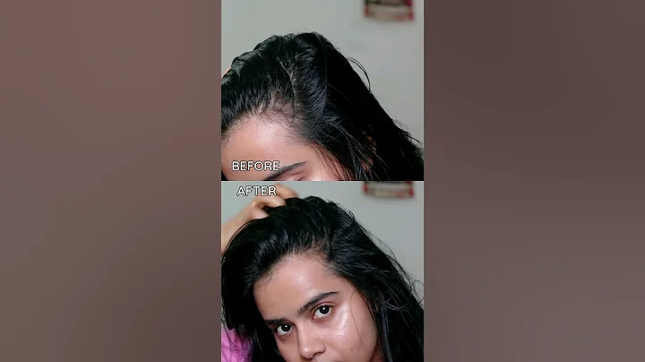 This VIRAL ingredient: Rosemary Actually works like😮😮 #shorts #viral #rosemary #haircare #hairgrowth