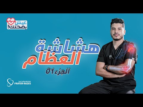 عيش بصحتك الحلقة 16 هشاشة العظام الجزء 1