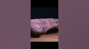 Fire over Sanitizer on my Hand.