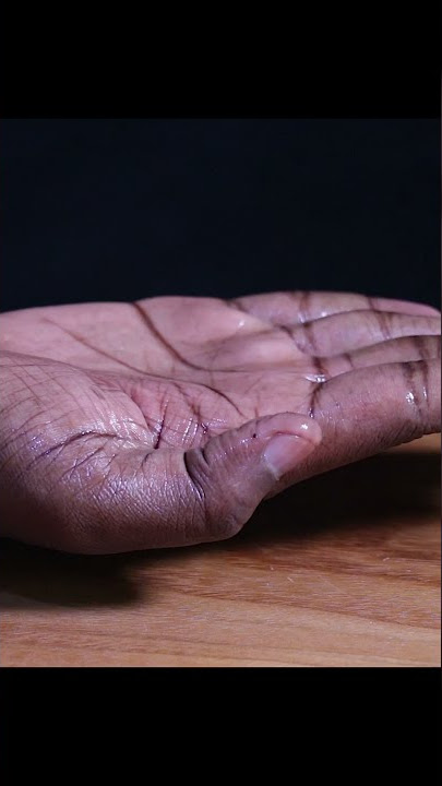 Fire over Sanitizer on my Hand.