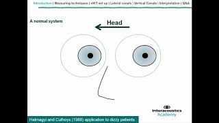 Video Head Impulse Testing Assessing all 6 semi circular canals - Otometrics