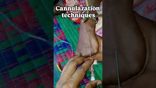 IV Cannulation Techniques | Step by Step Procedure | Nursing Skills & Clinical Practice #cannulation