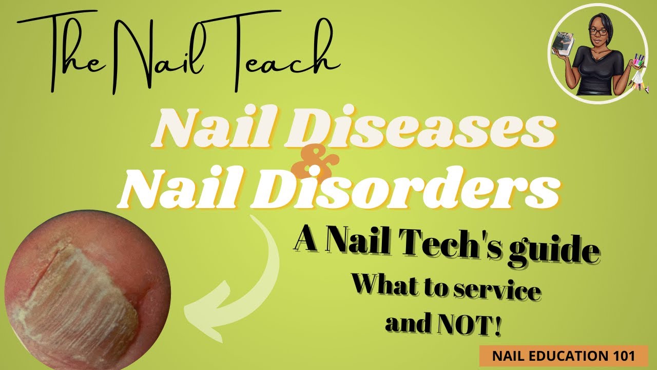 Nail fungus - Symptoms and causes - Mayo Clinic