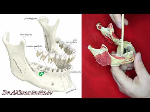 Анатомия нижней челюсти, mandibula, Ахмадудинов А.М.