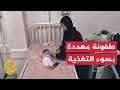 غزة.. مراسل الجزيرة يرصد تزايد حالات سوء التغذية بين الحوامل والأطفال نتيجة استمرار الحصار