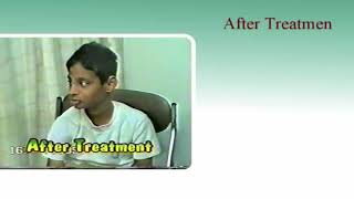 Autism Treatment with Dr. Oswal's G Therapy