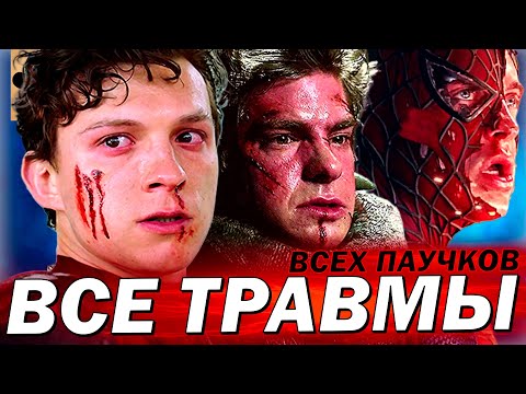 видео: 🤕 ВСЕ ТРАВМЫ КАЖДОГО ЧЕЛОВЕКА-ПАУКА (ТОБИ МАГУАЙР, ЭНДРЮ ГАРФИЛД, ТОМ ХОЛЛАНД)