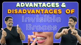 Advantages & Disadvantages of Invisible braces. கண்ணுக்குத் தெரியாத கிளிப் போடும் முன் இதை பாருங்கள்