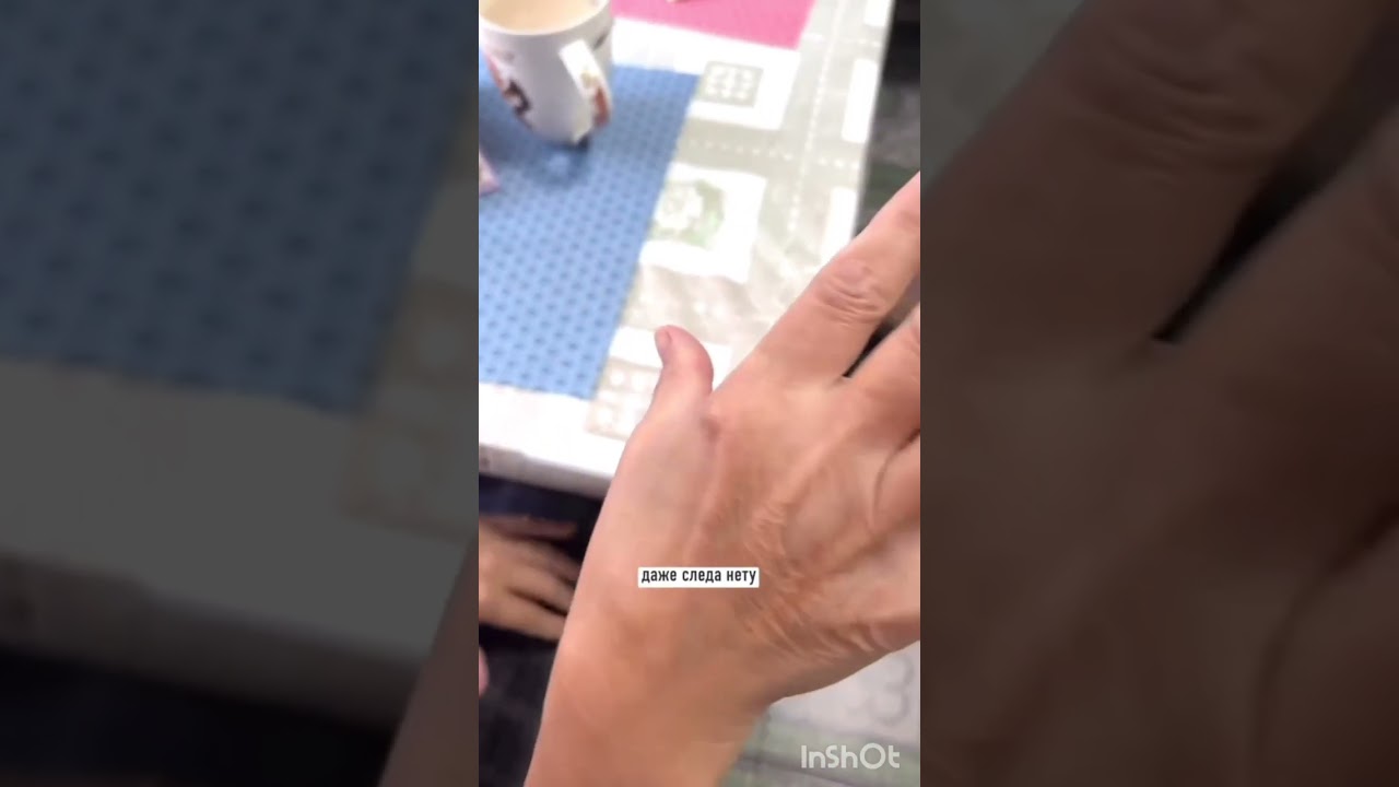 Как избавиться от нейродермита