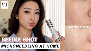 CICA REEDLE SHOT GAVE ME RESULTS IN 4 DAYS!!! | VT COSMETICS