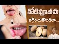 How to Get Rid of Mouth Ulcers | Diet Plan to Relief from Canker Sore | Dr. Manthena's Health Tips