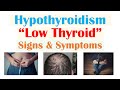 Hypothyroidism Signs & Symptoms | & Why Symptoms Occur