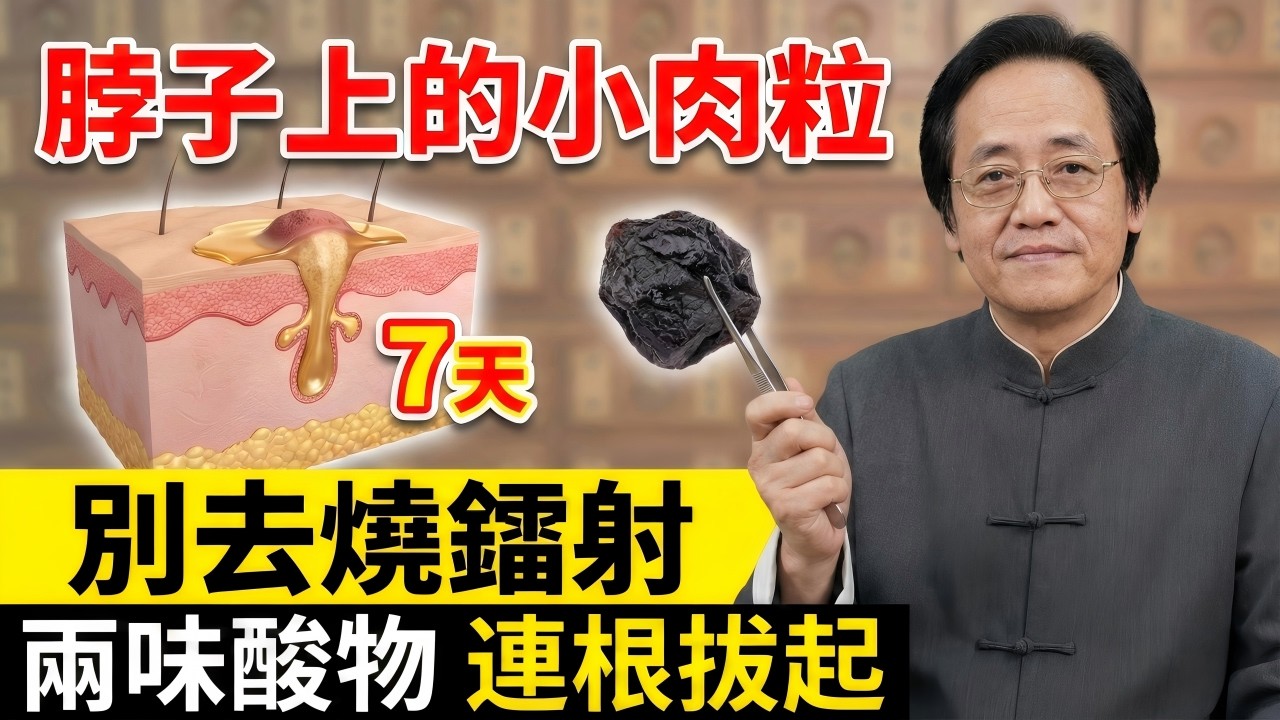 【停止鐳射燒灼】廚房裡的“酸性手術刀”，兩味廢料竟是死肌剋星！物理學揭秘：如何不動刀瓦解30年頑固肉疣？#中醫 #倪海廈 #養生 #皮膚管理 #經方 #自然療法 #健康 #黃帝內經 #物理學中醫