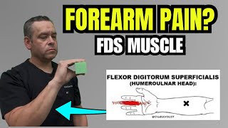 Douleur Du Muscle Fléchisseur Superficiel Des Doigts Fsd Expliquée Anatomie, Fonction Et Symp...