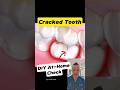 Is Your Tooth Cracked 3 Quick Home Tests You Can Try Dentallan Dentist Shorts