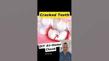 Is Your Tooth Cracked? 3 Quick Home Tests You Can Try #dentallan #dentist #shorts
