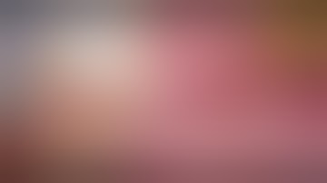 DEXTER Cholecystectomy - Dr. Mignot, Groupe Hospitalier de Saintes, France