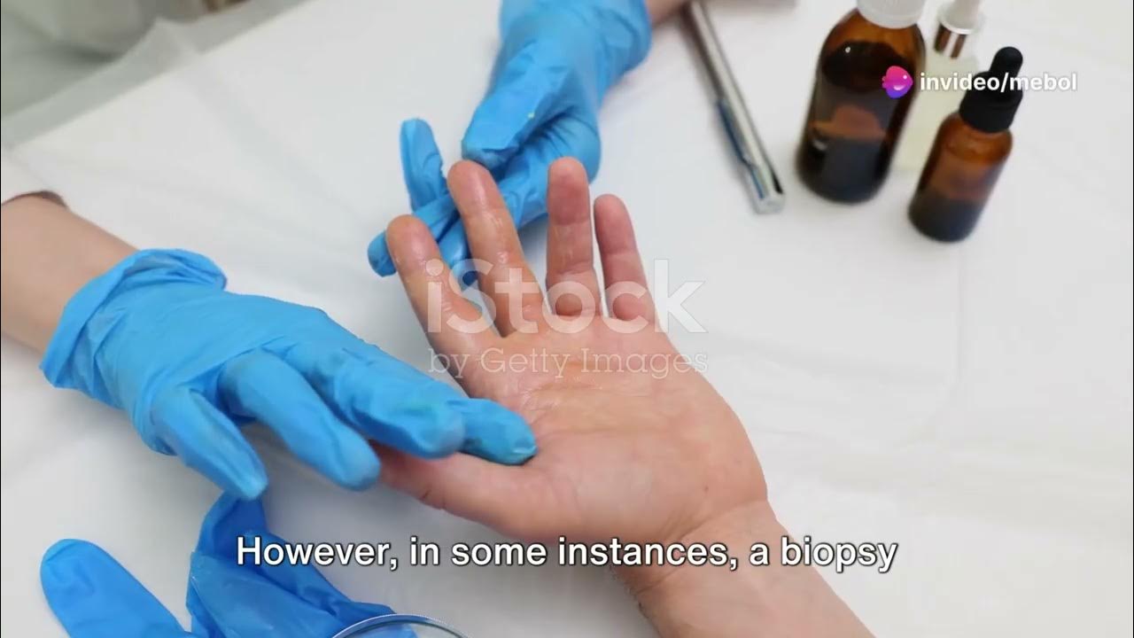 unveiling-the-truth-venereal-warts-itchy-genital-area-genital-warts