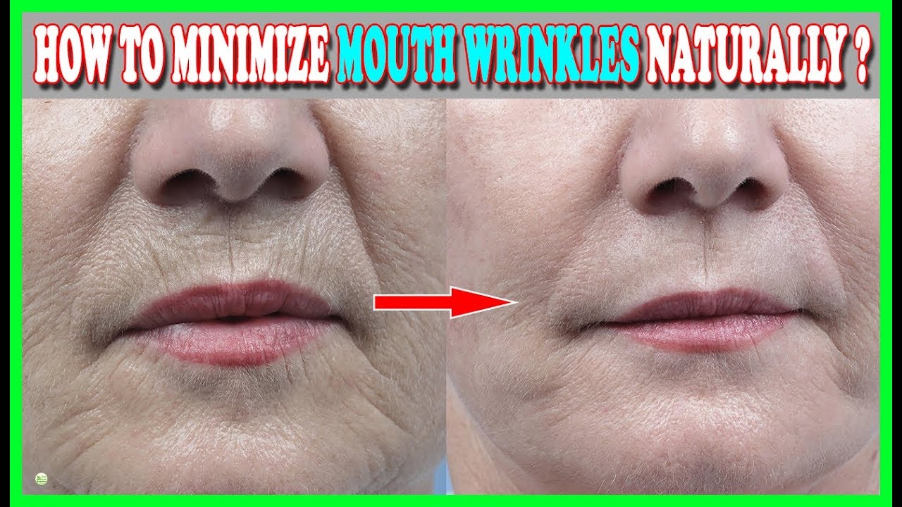 5 Natural Ways To Minimize Wrinkles Around Your Mouth - Wrinkles