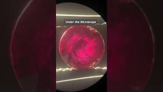 Famous Unheated Madagascar Round Ruby under the microscope with GRS Cert. #ruby #unheatedruby #roundruby Wealth