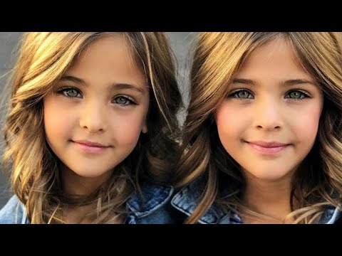 Необычные Сиамские Близнецы, Которые Существуют На Самом Деле