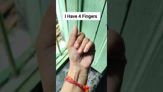 I have 4 fingers 😳😨 #shorts #trending #funny #youtubeshorts #magictricks