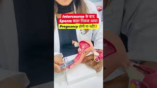 Intercourse ke baad Sperm bahar aana? Pregnancy hogi? 🤔 #pregnancytips #fertilitytips