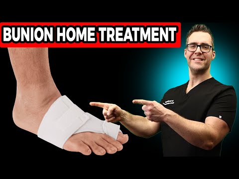 Can Bunions Be Reversed Without Surgery? *Home Guide*