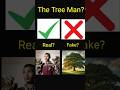 A Man with Tree Branches #shorts #tree syndrome #Facts #Untold facts