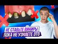 Эта ошибка при выборе ВИНИРОВ будет стоить вам зубов!