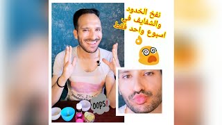 وداعا لمراكز التجميل وجهك وشفايفك هيتنفخو يعني هيتنفخو ف خلال اسبوع واحد فقط وتحدي👌