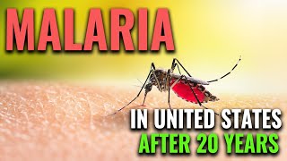 Malaria Cases in US Raises Alarm by Doctor Mike Hansen 16,350 views 8 months ago 5 minutes, 33 seconds