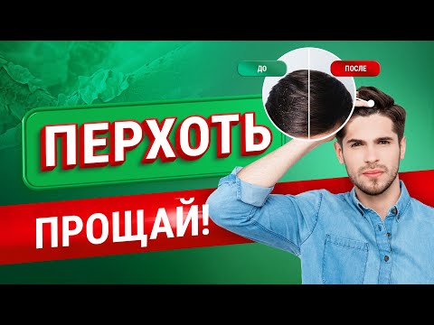 Появилась ПЕРХОТЬ: что делать? Как избавиться от перхоти?