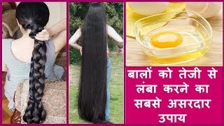 Extreme Hair Growth Mask For Normal-Dry-Oily Hair -World's Best Remedy for Hair Growth
