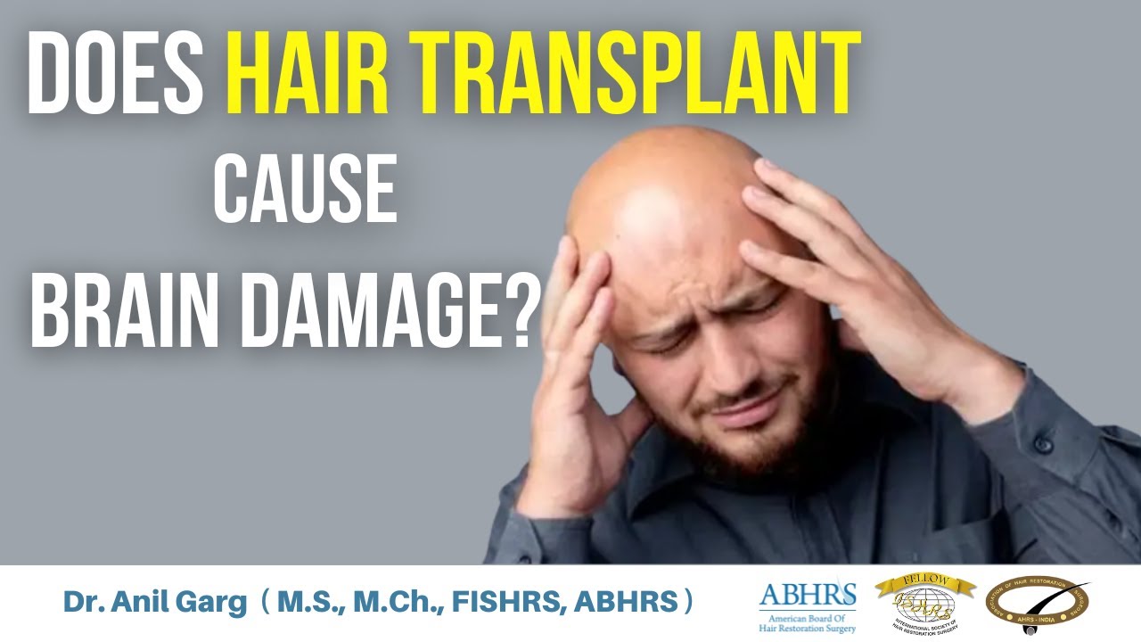 Does Hair Transplant Cause Brain Damage? Dr. Anil Garg YouTube