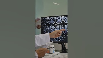 How A.I. assists in diagnosing diseases faster?