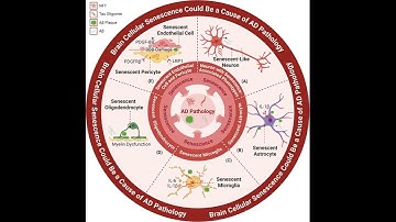 Зомби-клетки запускают болезнь Альцгеймера: порочный круг старения клеток мозга