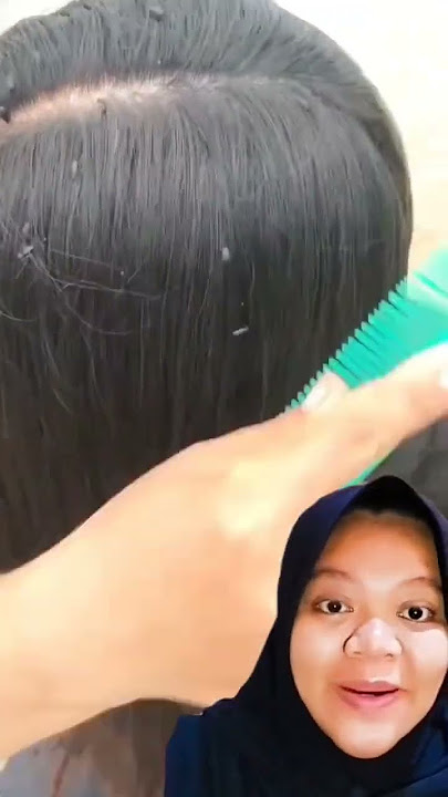Abis dari kali banyak kutunya #reaction #shortvideo #storytelling #viral #trending #shorts