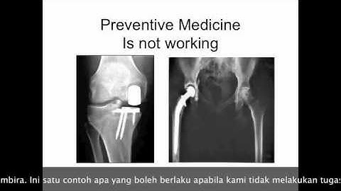 The Human Spring Approach And It