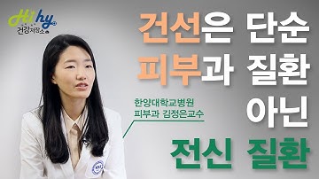 피부 건선은 단순 피부과 질환 아닌 전신 질환. 생물학적 제제로 면역치료