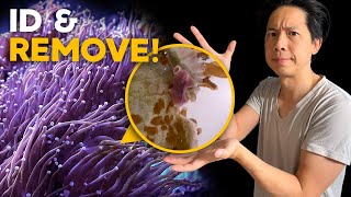 Euphyllia Eating Flatworm  How to remove them from Torch Coral!