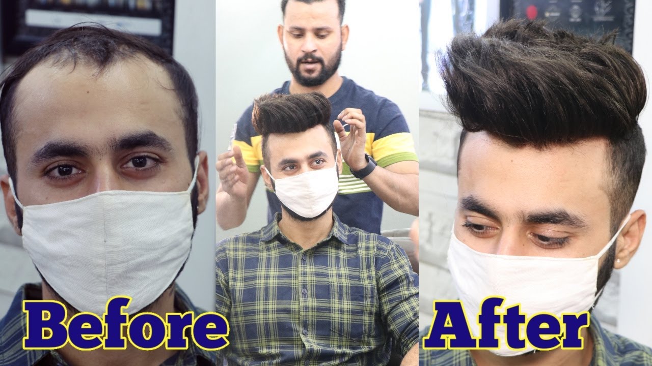 Hair patch short videos  Hair patch looks  Anas sheikh hair solutions   call Us  9650914665  YouTube